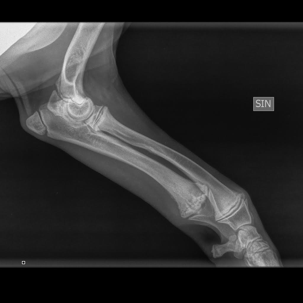 HOD, hypertrofinen osteodystrofia